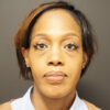 Eyelid Surgery case #3963