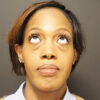 Eyelid Surgery case #3963
