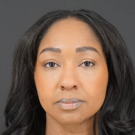 Eyelid Surgery case #4434