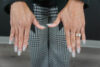 Fat transfer to hands case #4675